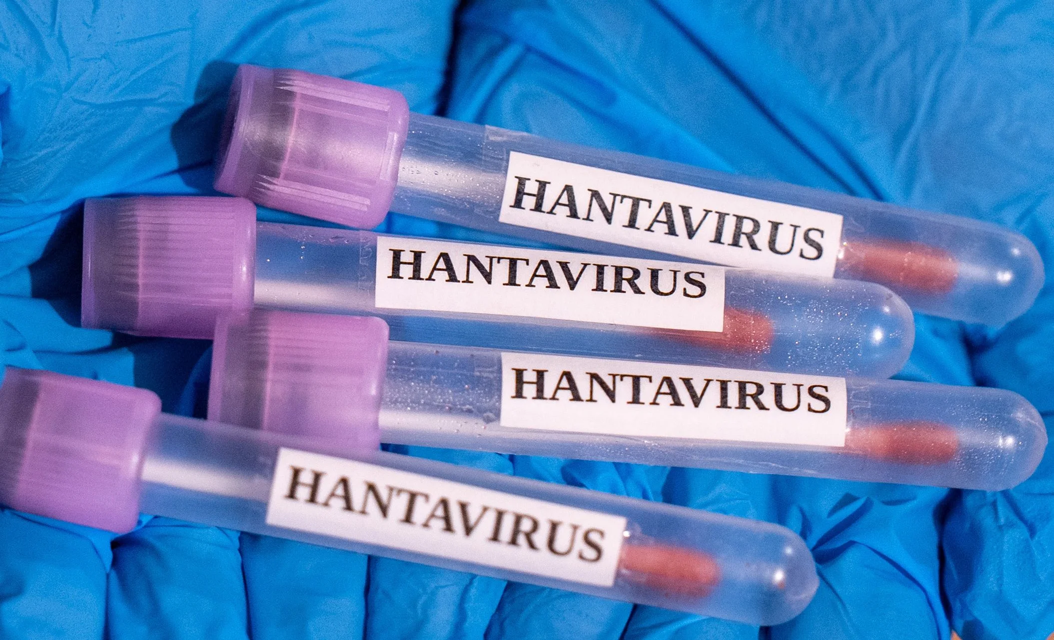 Assessing the Hantavirus Risk on Cruise Ships: Why It’s Manageable